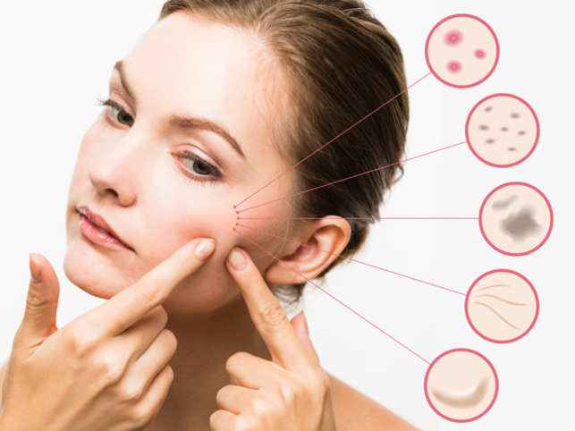 Essential skin care tips for monsoon that keeps skin healthy and glowing